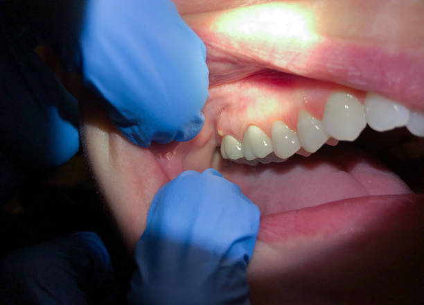 Best Urgent Care for Lost Fillings or Crowns in Princeton, IL