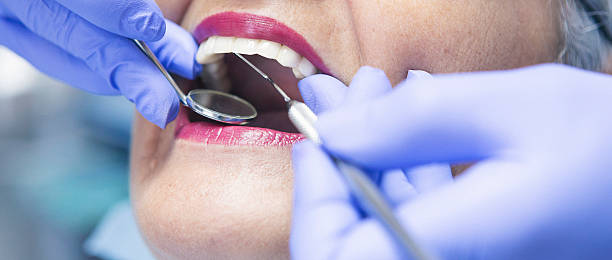 Best Emergency Dental Care for Broken or Chipped Teeth in Princeton, IL